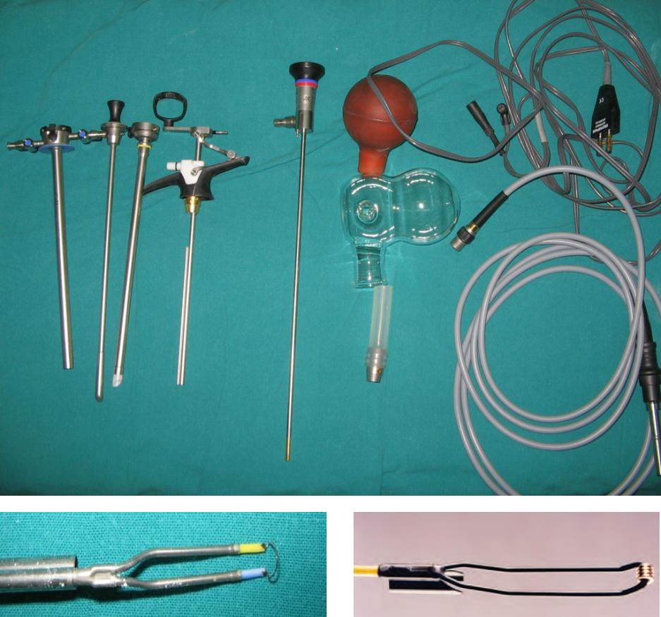 lithotomy-pos-2