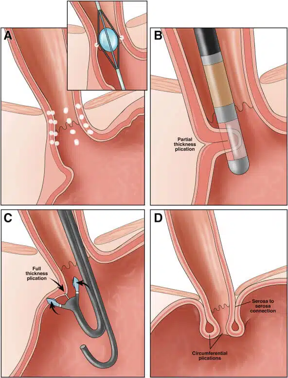 1-s2-0-s1542356513008719-gr1-2