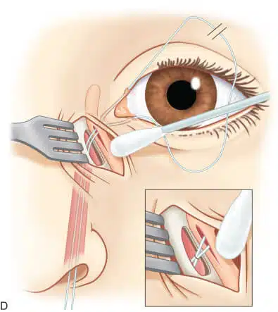 3-s2-0-b9780323497558000384-f003004-011d-9780323497558-2