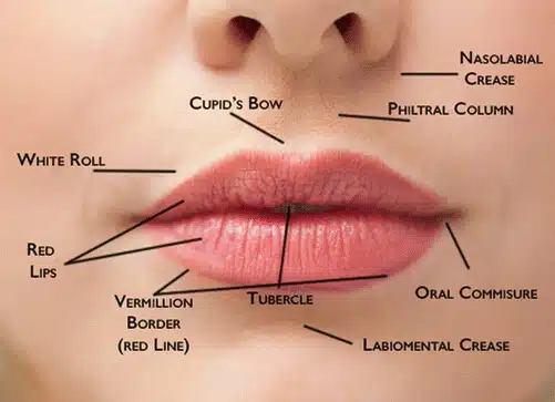 الشفة المشقوقة من جانب واحد