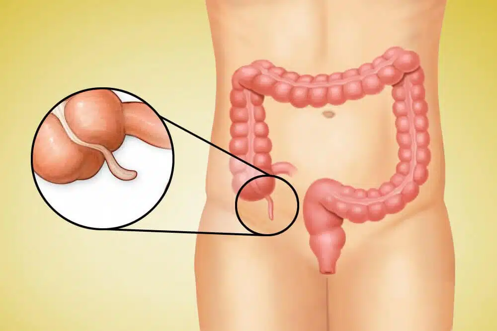 Appendix in human body