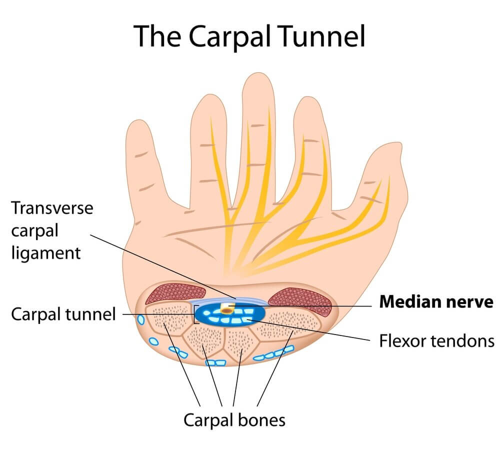 carpaltunnelsurgerybothhands-2