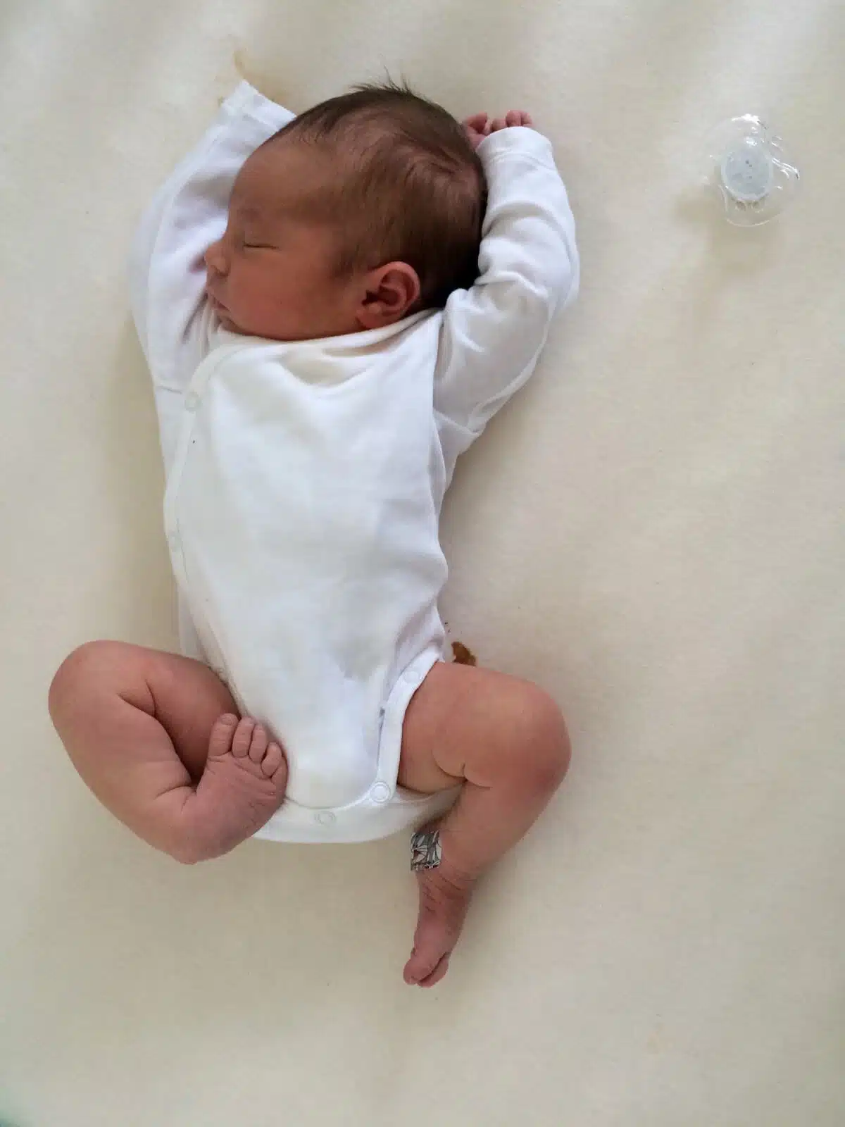 علاج اعوجاج القدم (القدم الحنفاء)