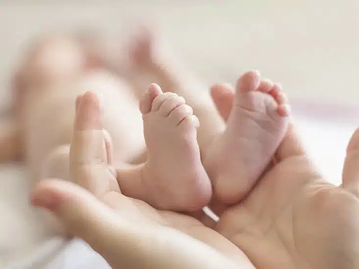 علاج اعوجاج القدم (القدم الحنفاء)