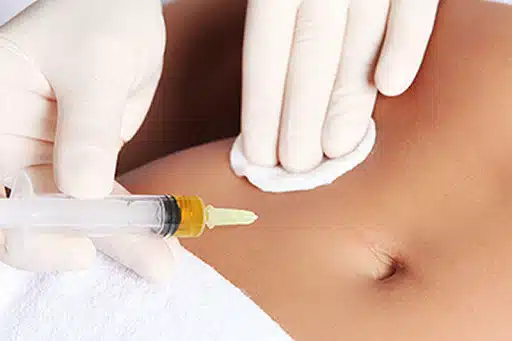 mesotherapy555