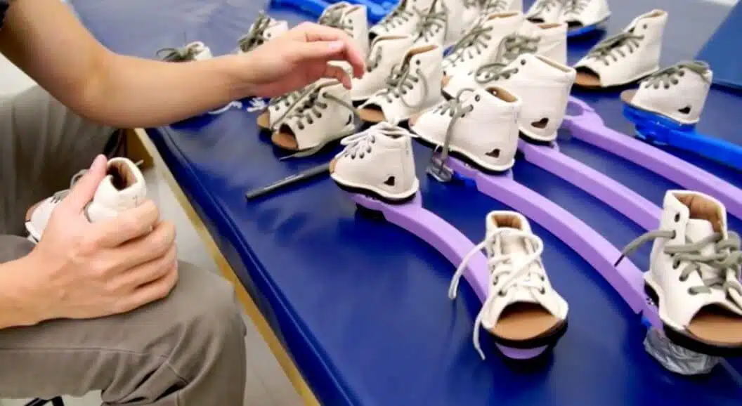 علاج اعوجاج القدم (القدم الحنفاء)