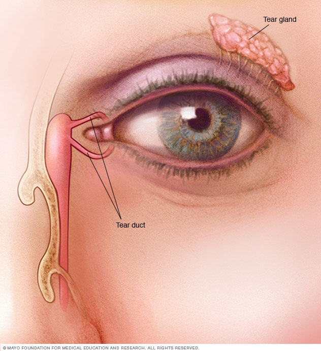 risk-serious-complications-increases-older-patients-dacryocystorhinostomy-767px-2