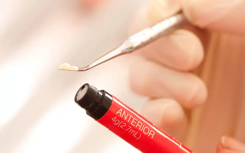 dental-filling-composite-5