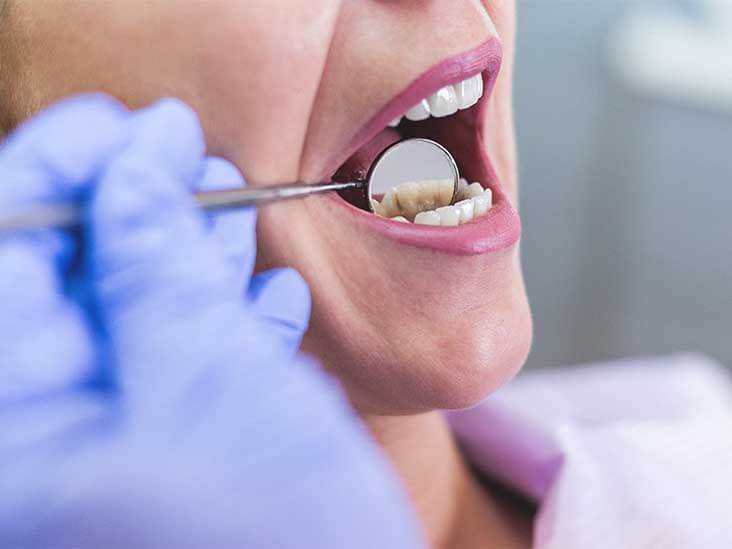 female_dentist_mouth_732x549-thumbnail2