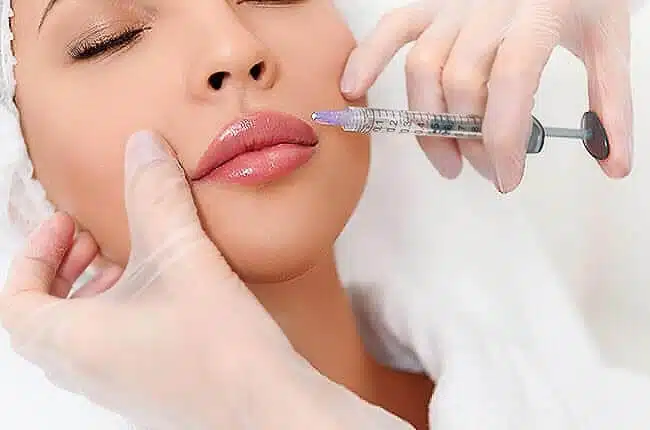 botox treatment