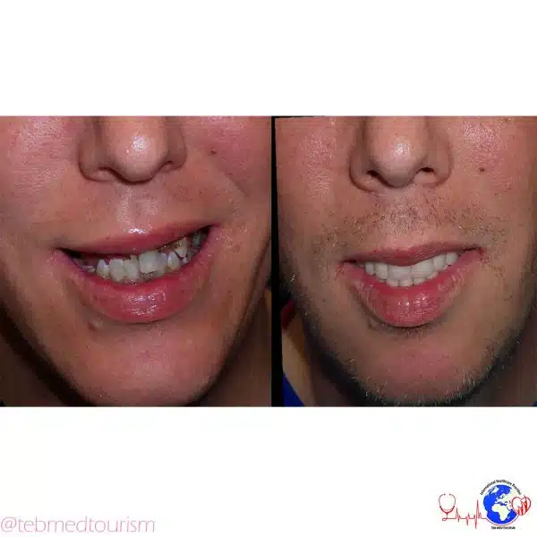 after-the-crowns-e1598172015272