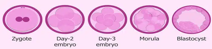 blastocyst-et22