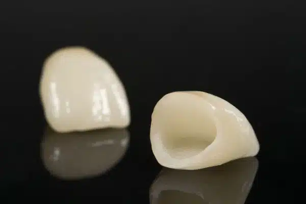 dental-crowns-7-e1598172034216