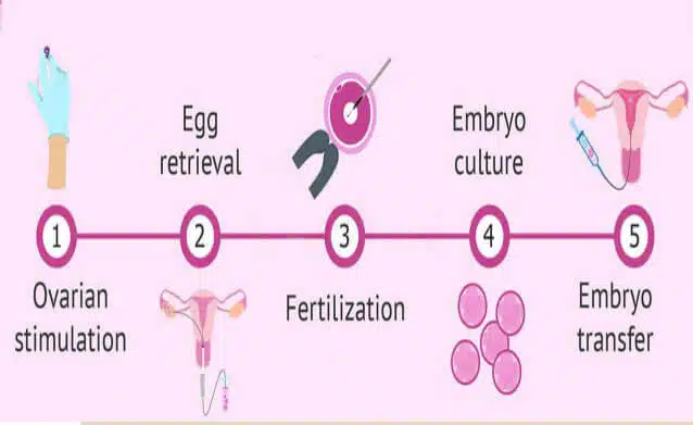 ivm-treatment-in-hyderabad22