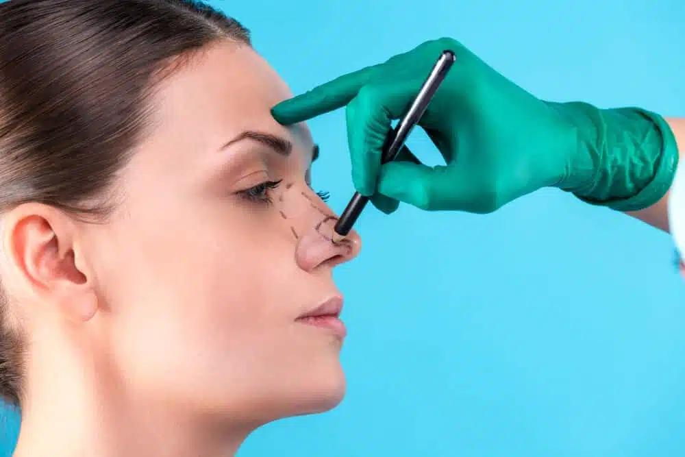 measuring the nose pre surgery