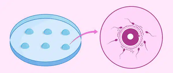 ivf-petri-dish-with-eggs-and-sperm-2