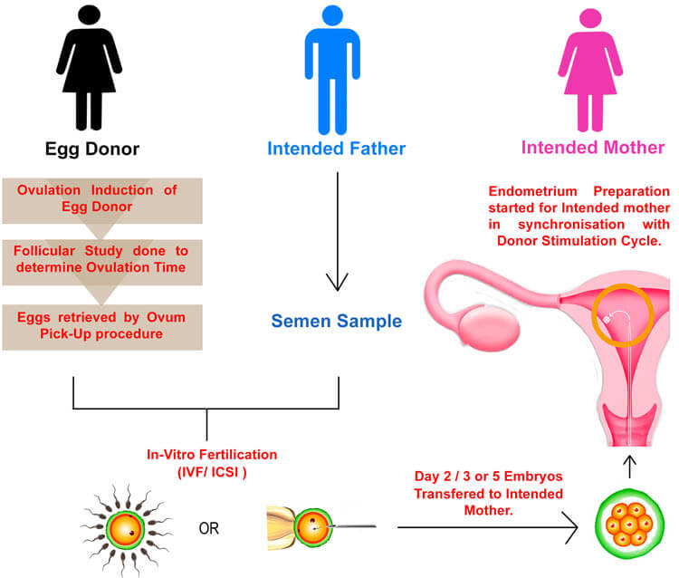 ivf-with-egg-donor-2