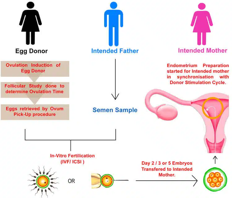 ivf-with-egg-donor-2