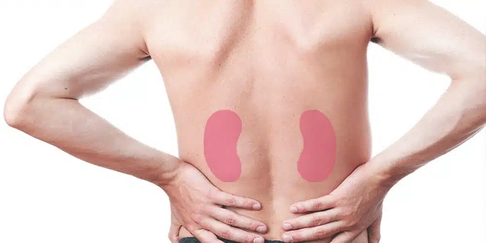 پیوند کلیه10