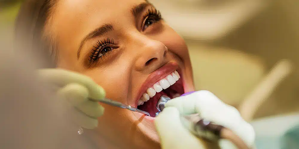 01لبخند هالیوودی