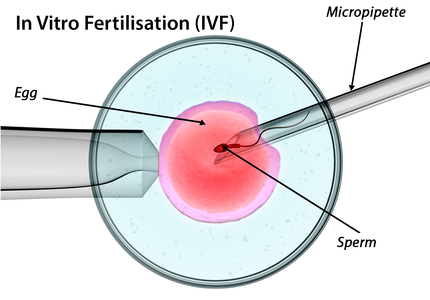iui02