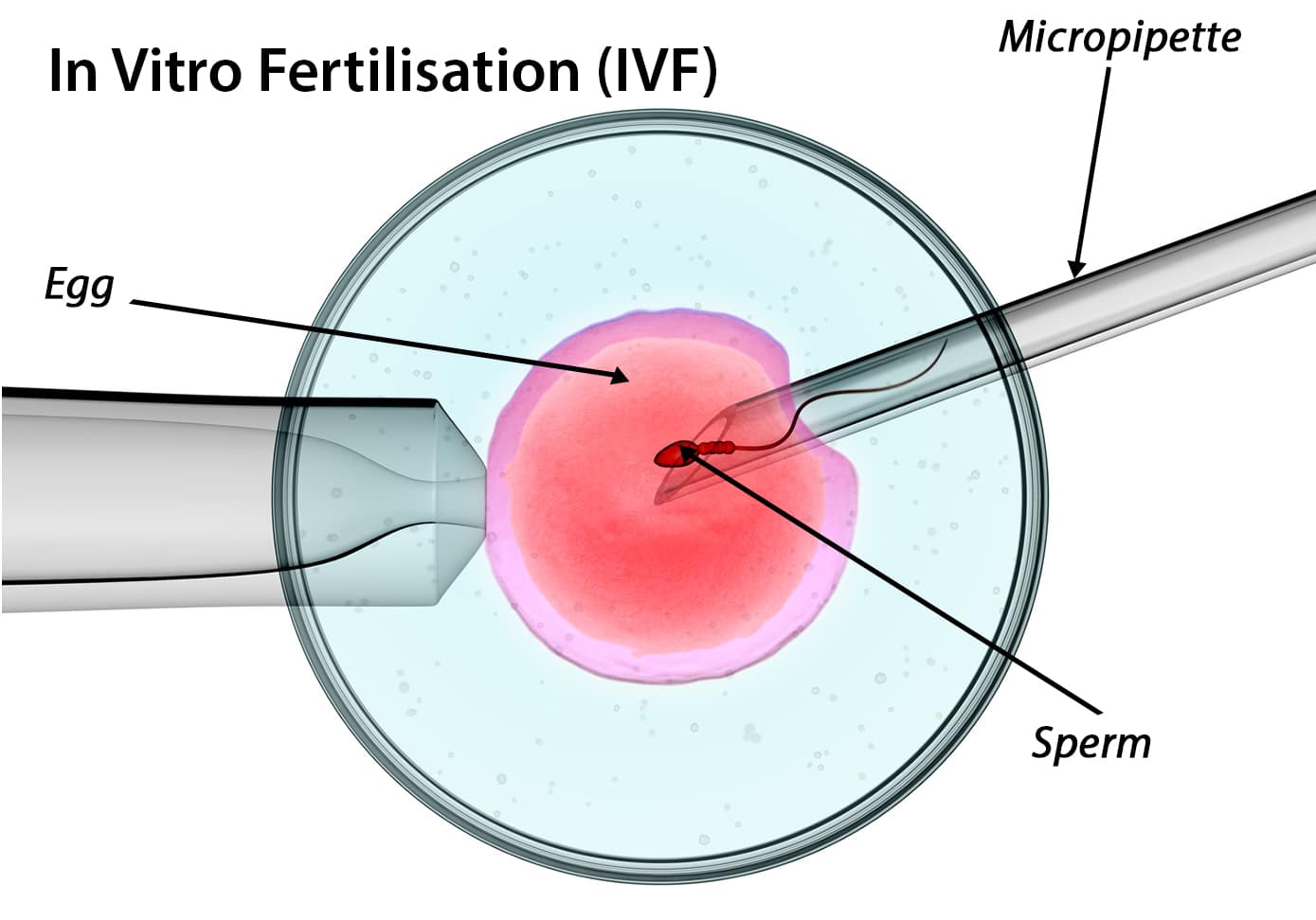 iui02