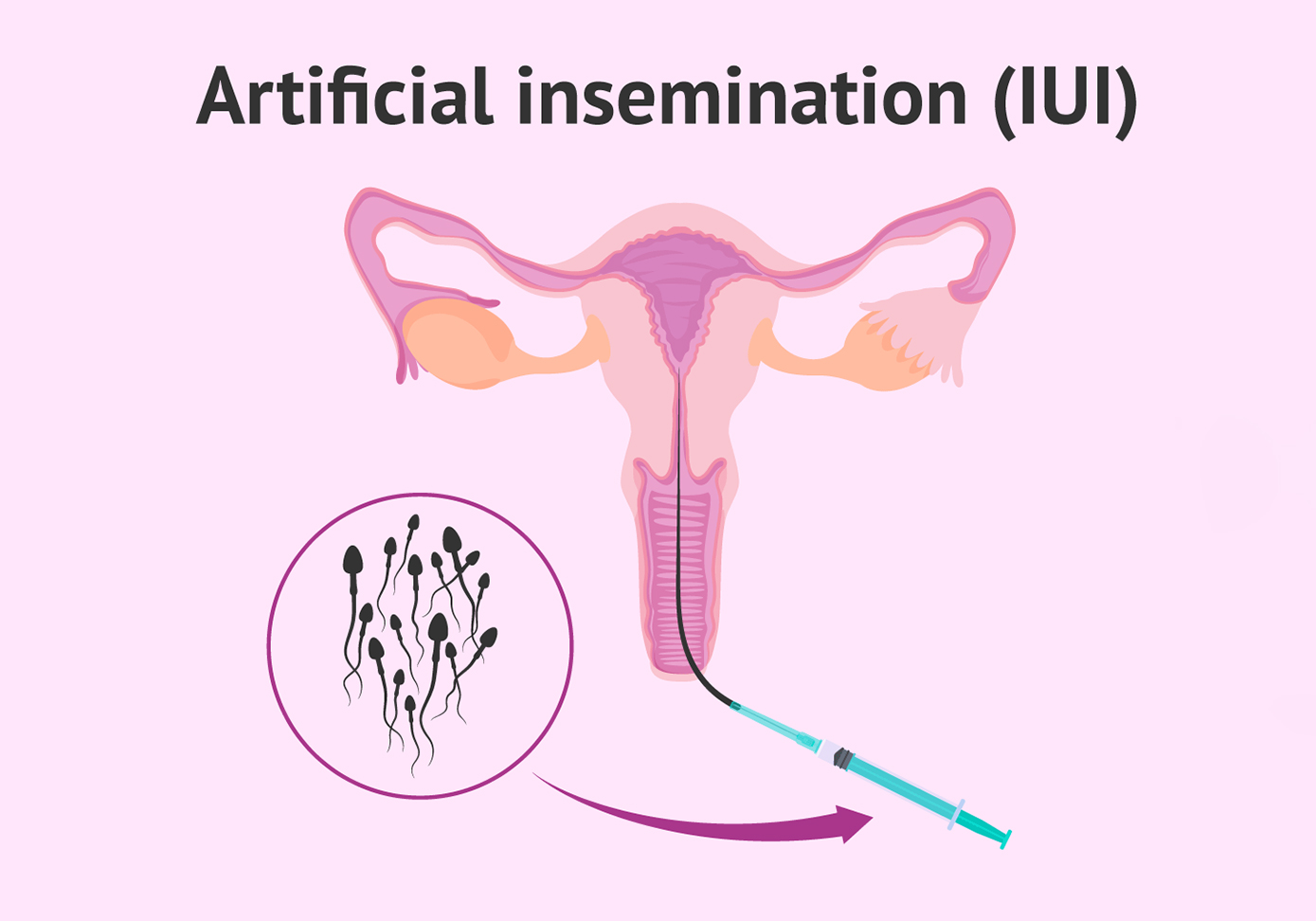 iui13-2