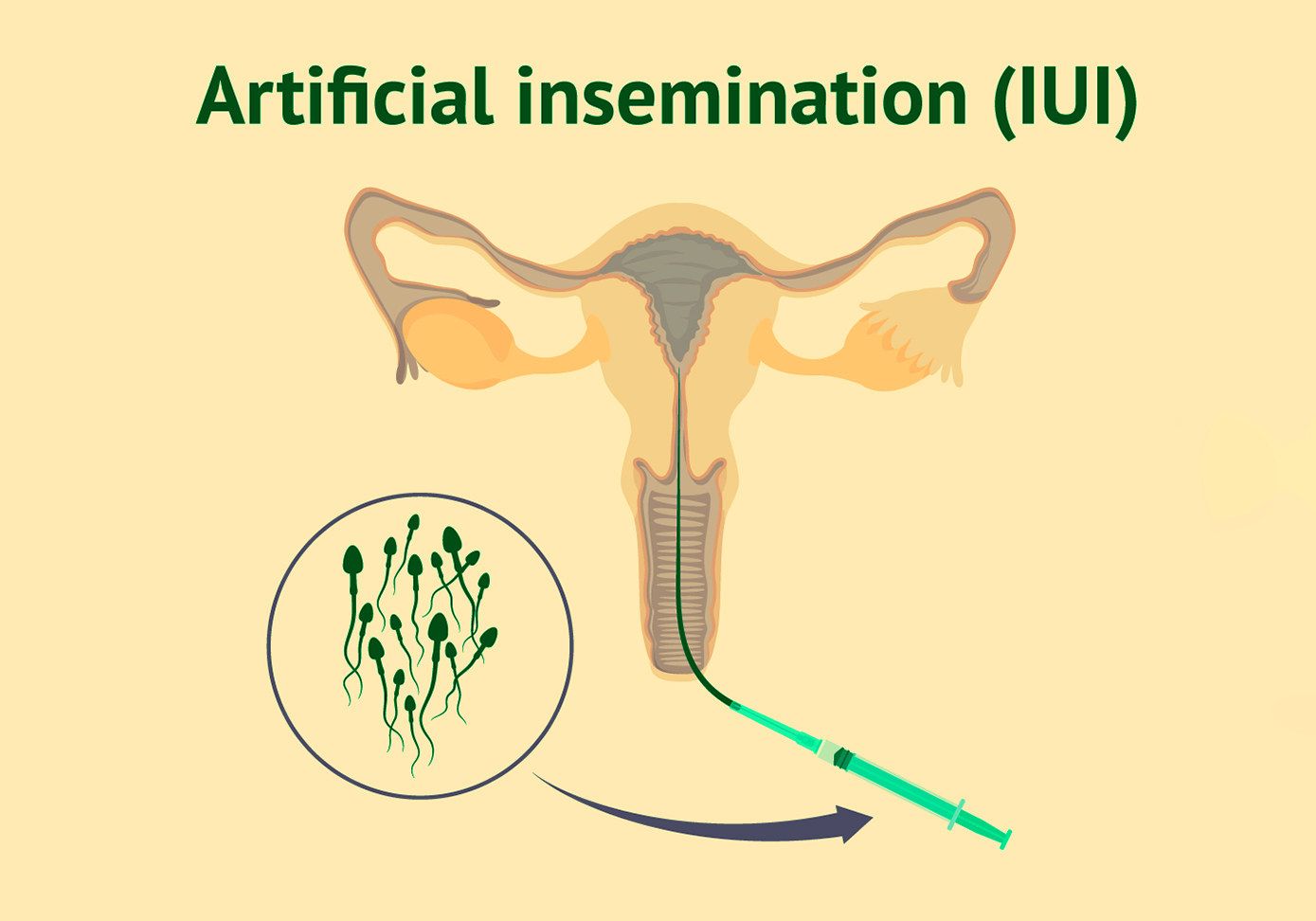 iui20-2