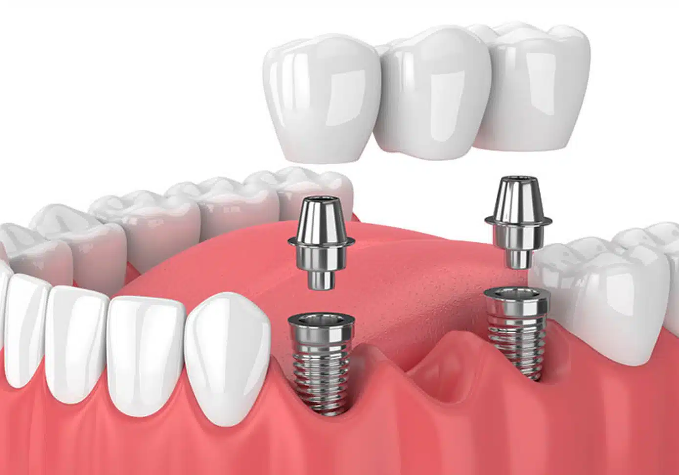 %d8%a7%db%8c%d9%85%d9%84%d9%86%d8%aa