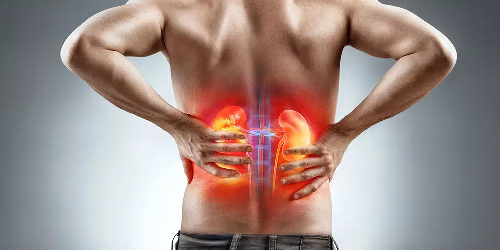 زراعة الکلیة24 1