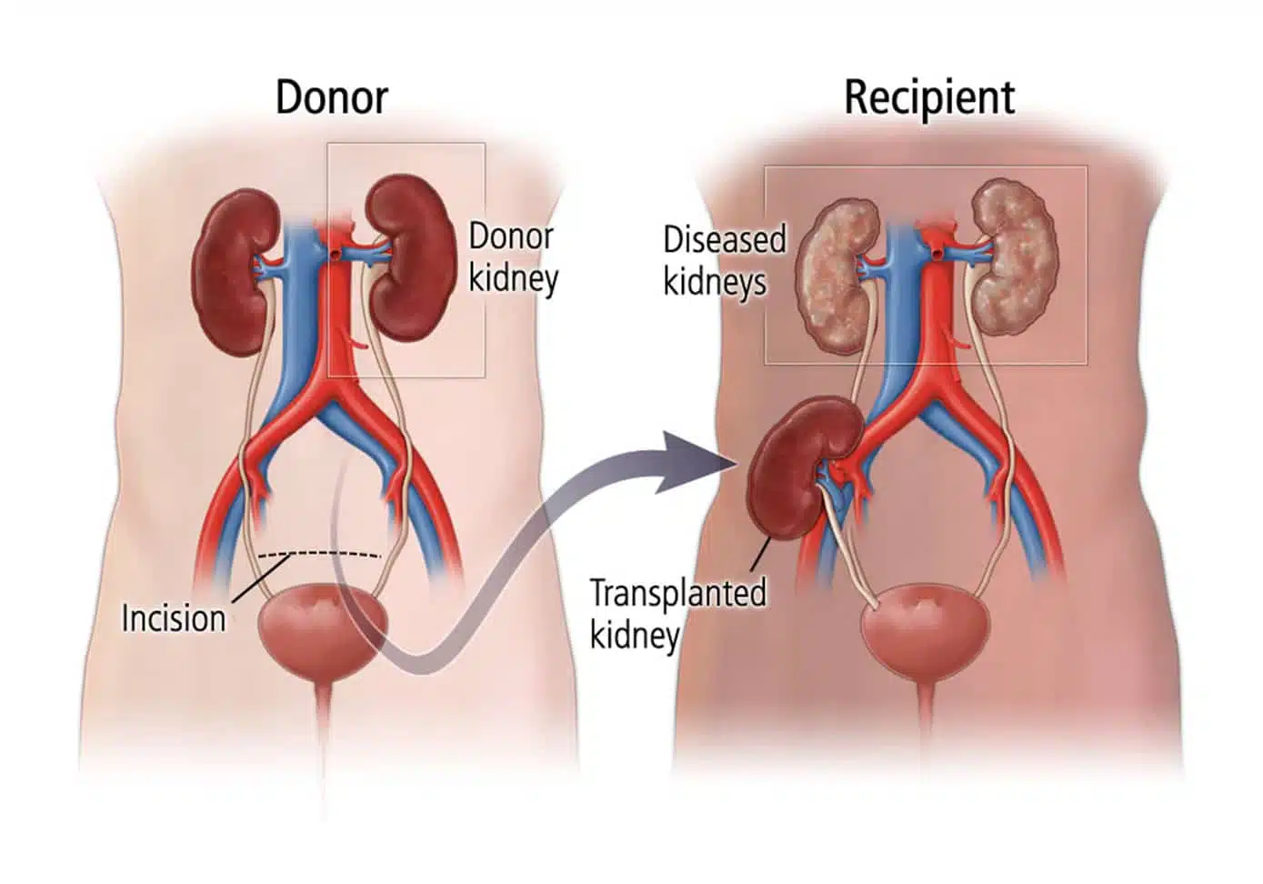%d9%be%db%8c%d9%88%d9%86%d8%af-%da%a9%d9%84%db%8c%d9%8726