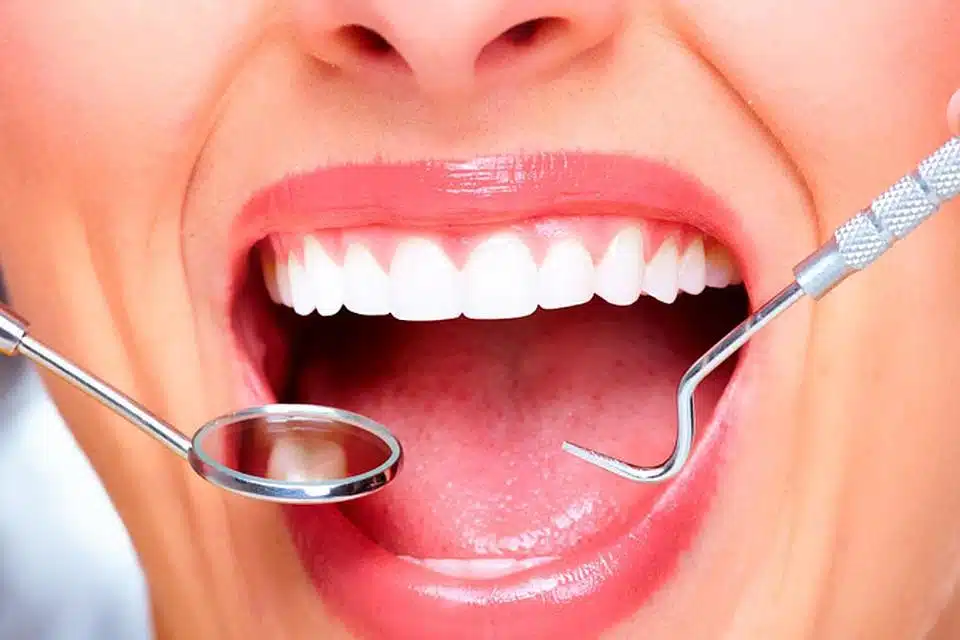 14000920-hollywood-smile-2