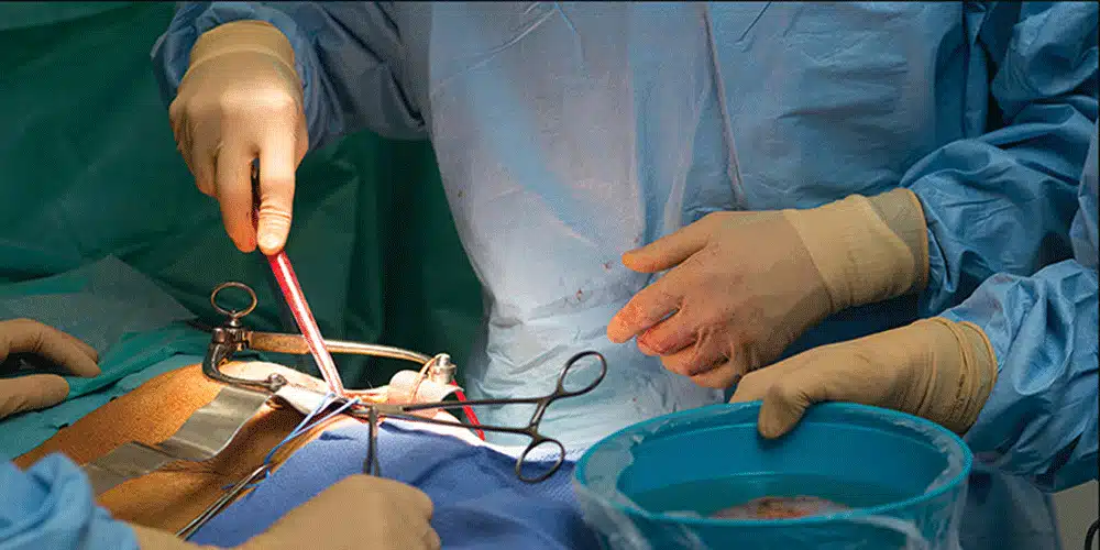 هزینه پیوند کلیه