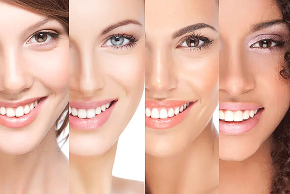 14001011 Hollywood Smile web quality