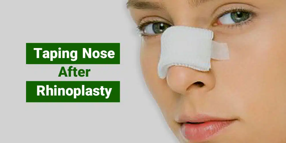 Taping Nose after Rhinoplasty 1