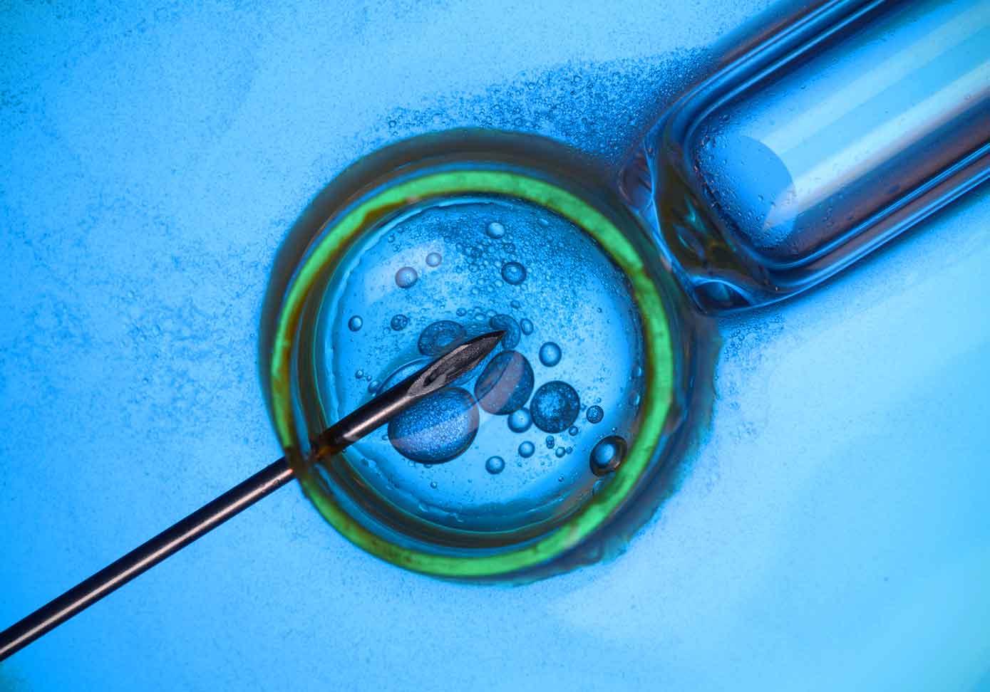 نحوه عملکرد IVF
