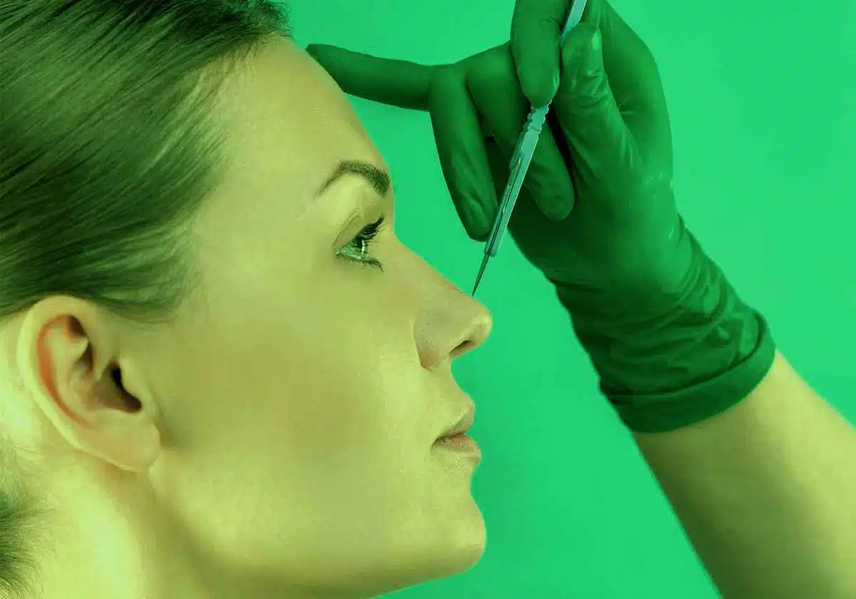 تجميل الأنف