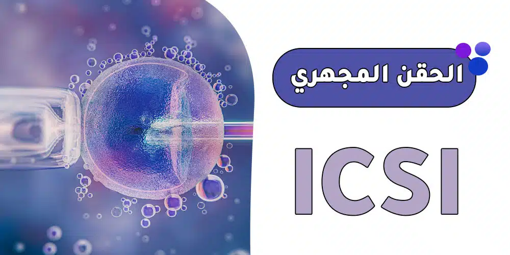 الحقن المجهري