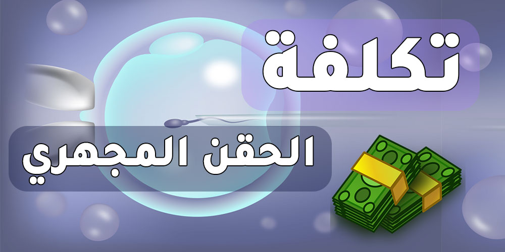 تكلفة الحقن المجهري