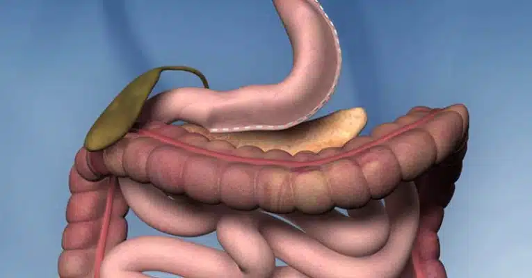 20240908 110248 article g3GC4