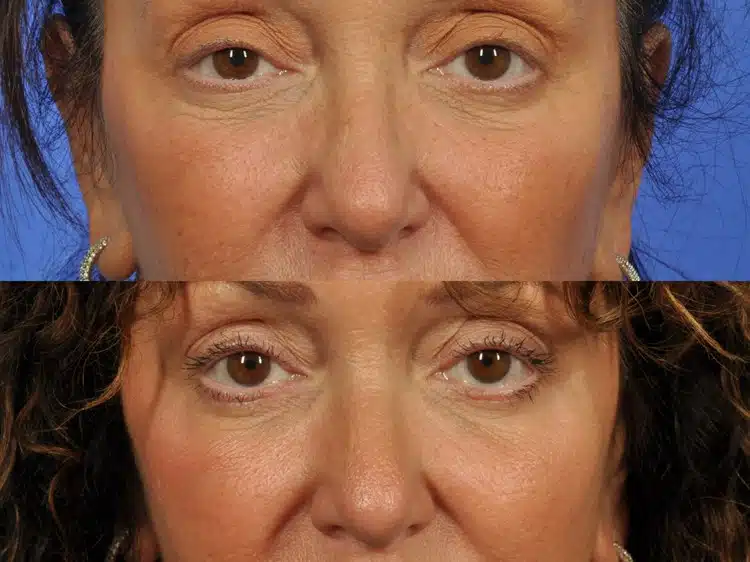 manzione-louise-20141222145525613-20180809161853322