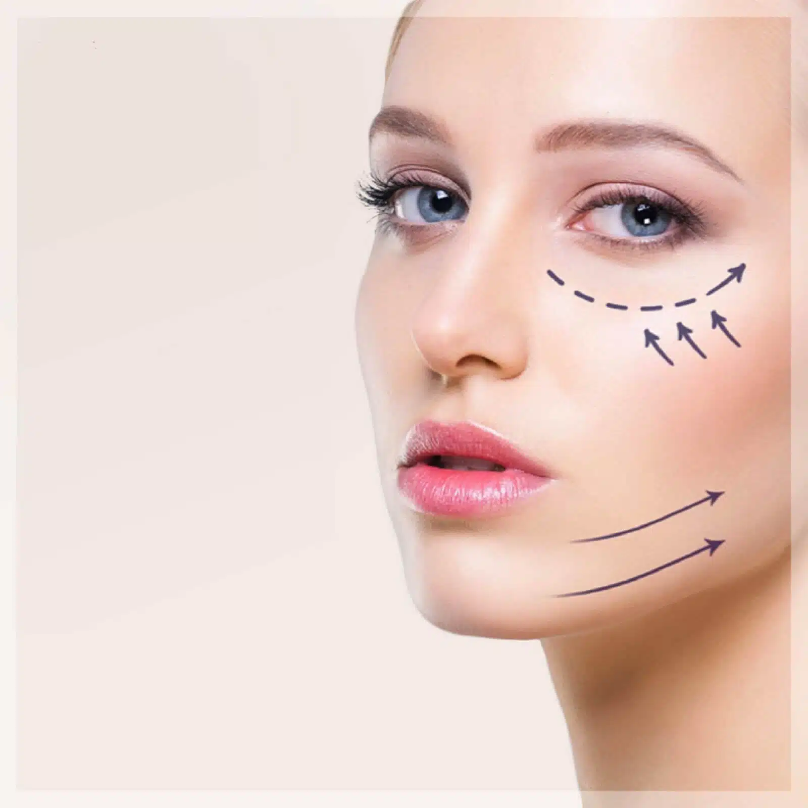 ogeeclinic-treatments-hifu-007