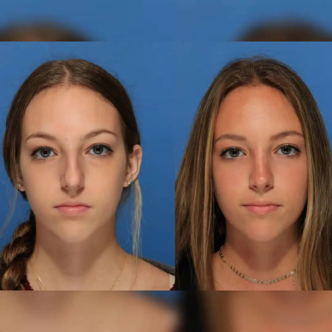 whatsapp-image-2019-01-12-at-17-34-49-2-2