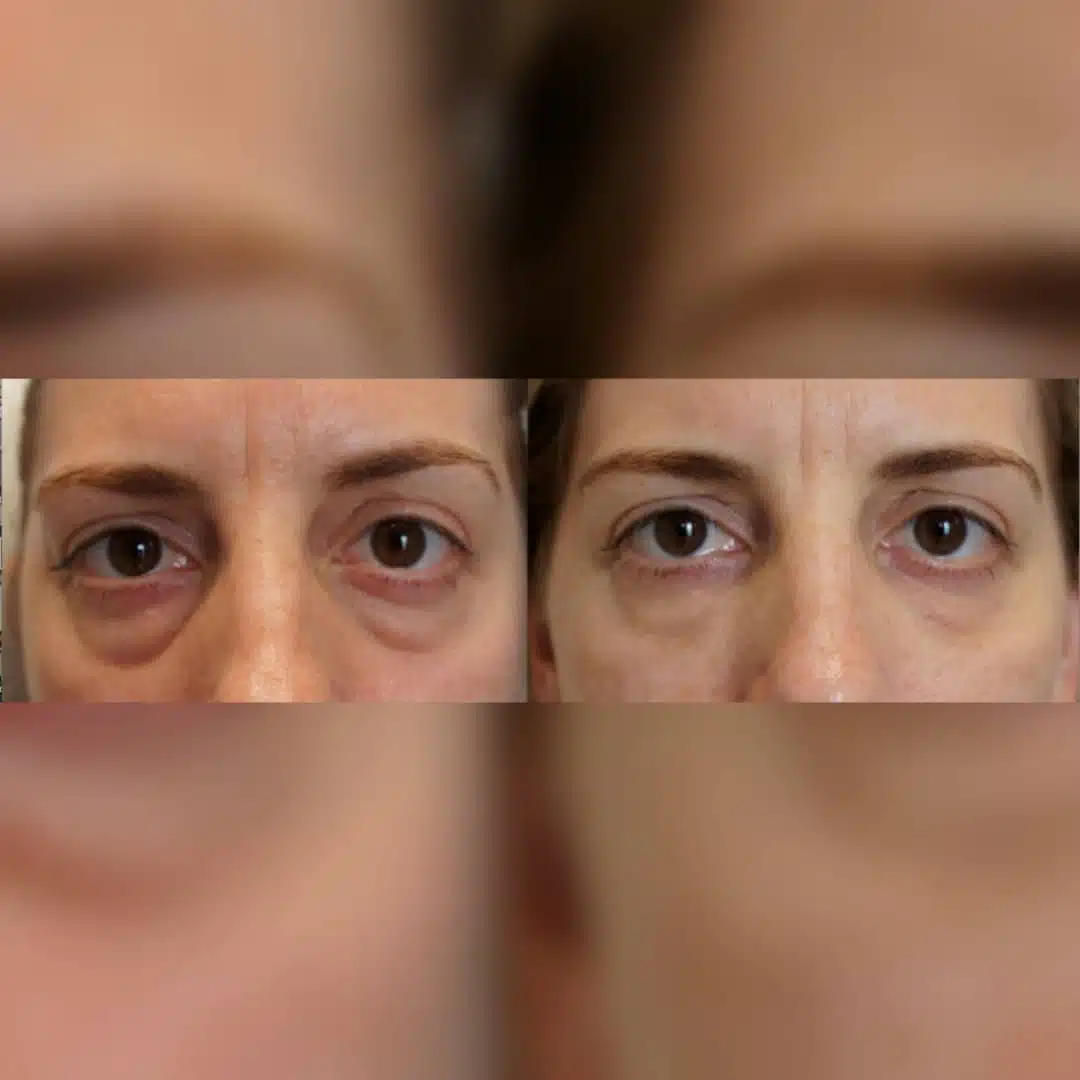 whatsapp-image-2019-01-13-at-11-59-12-1