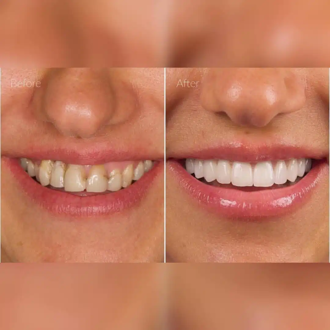 whatsapp-image-2019-01-14-at-12-34-501