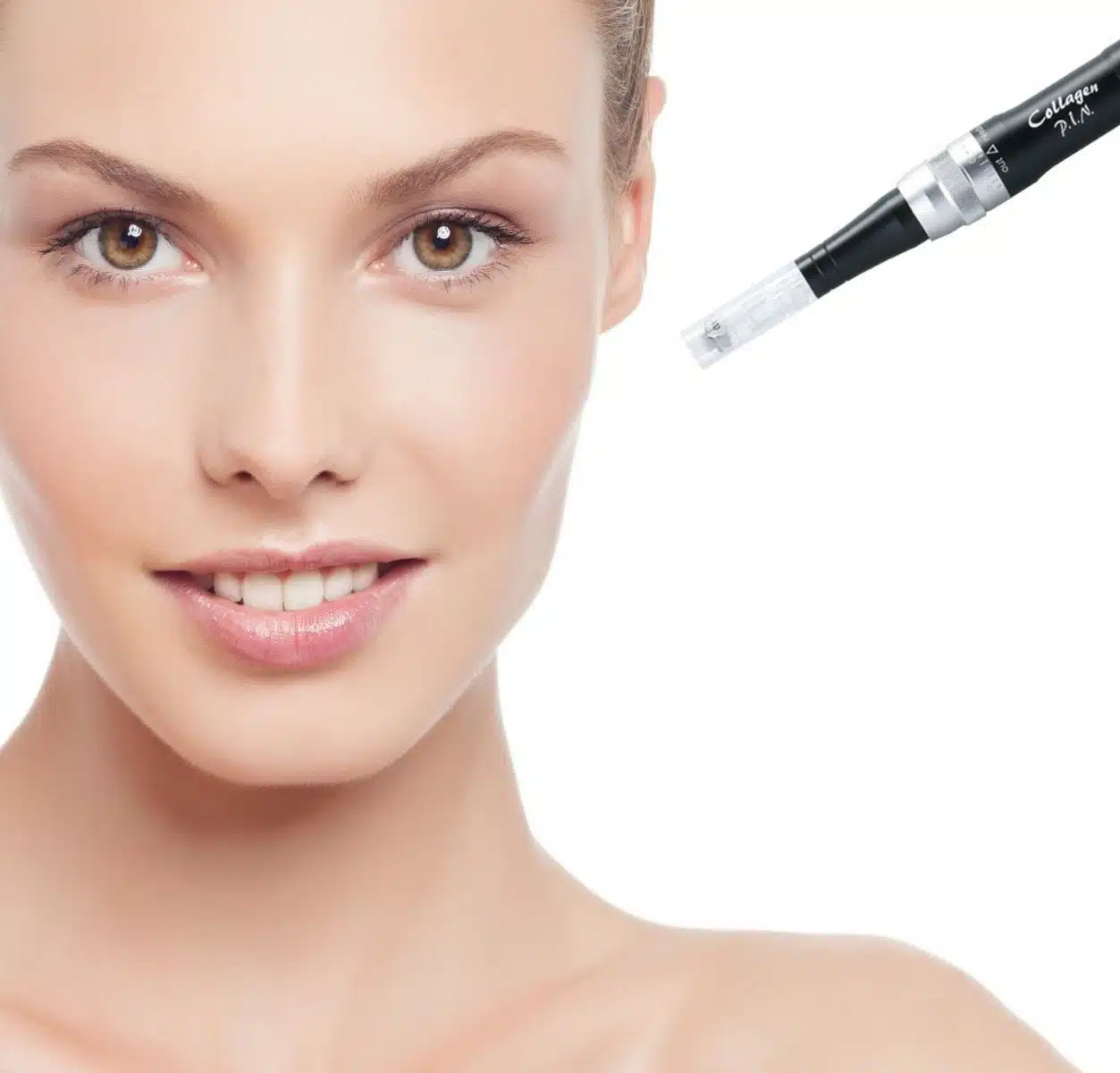 whatismicroneedling