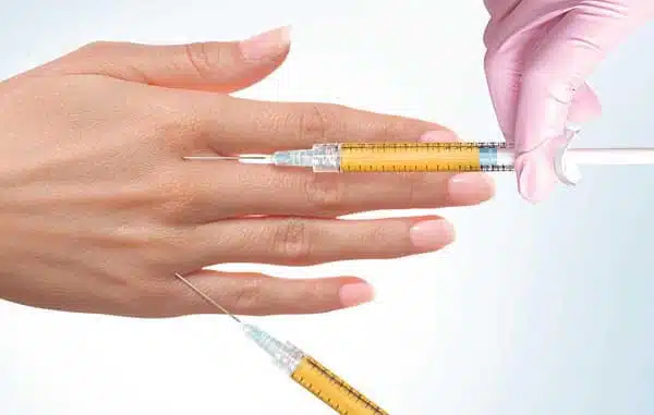 hand-rejuvenation-with-fat-grafting-1