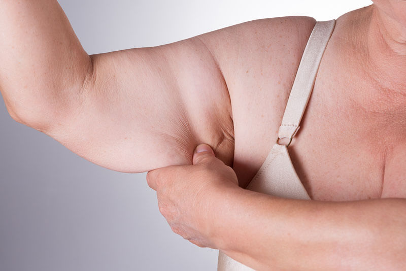 moeller-medical-liposuction
