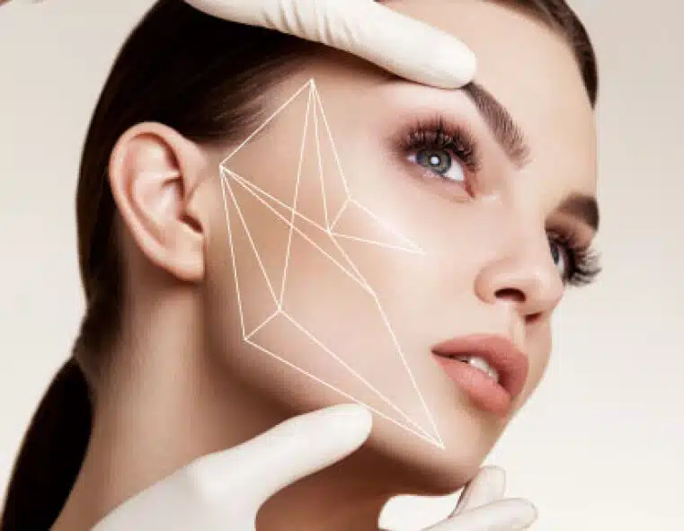 lifting-facial-fios-de-sustentacao-3