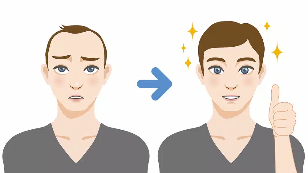 the benefits of hair transp 89e1ba5975